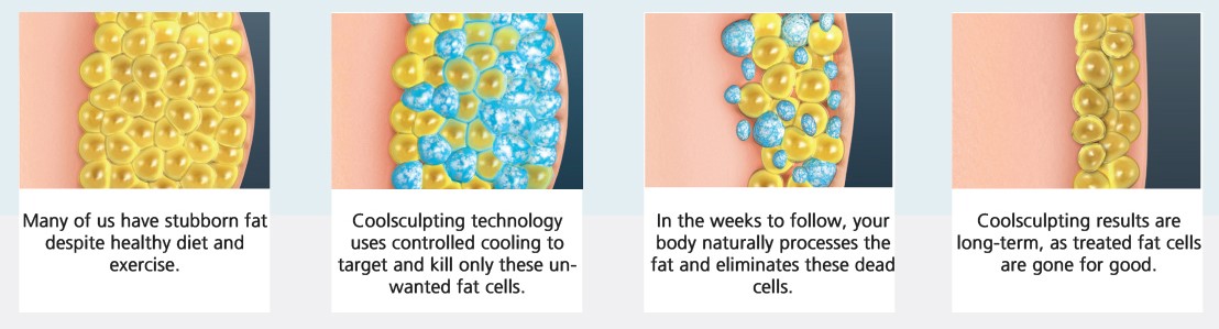 Cryolypolysis Process